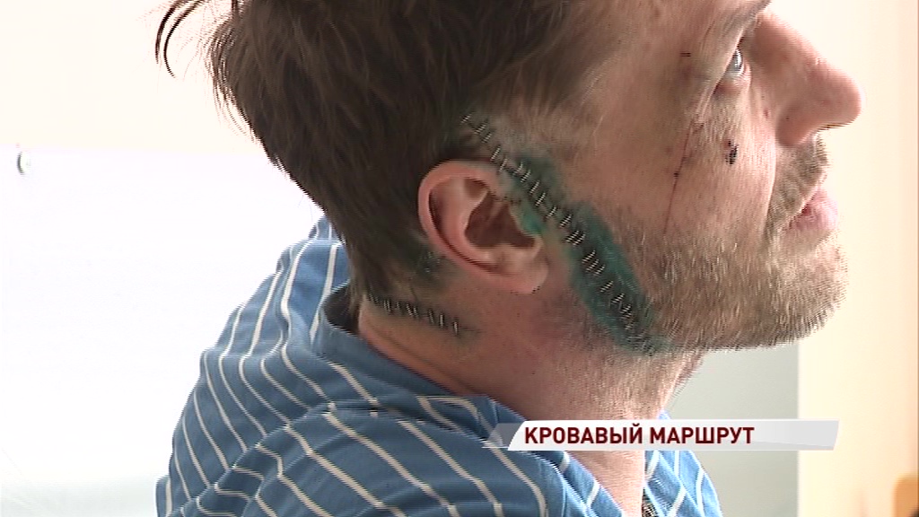 «Конфликта с пассажиром не было»: водитель рассказал о нападении буйного пассажира с ножом