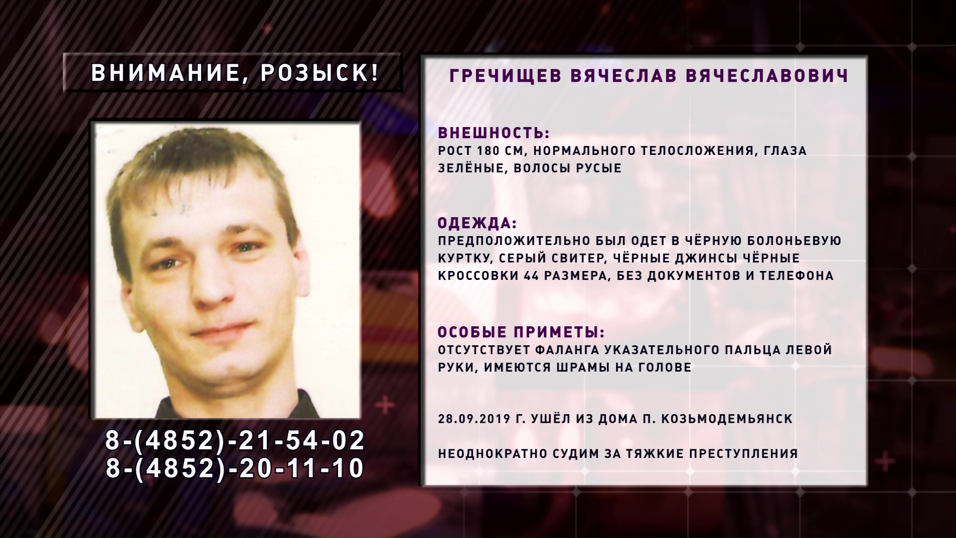 В области разыскивают рецидивиста со шрамами на голове